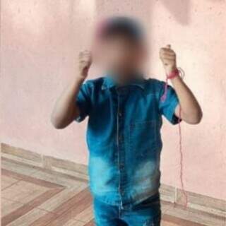 Menino de 8 anos respira por aparelhos após ser picado por escorpião