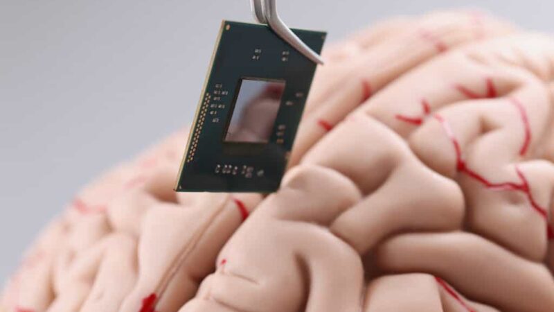 Chips cerebrais: China desafia Neuralink, de Musk