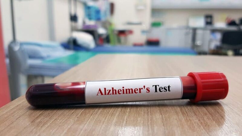 Exame de sangue testado no Brasil é capaz de detectar Alzheimer com mais de 90% de precisão