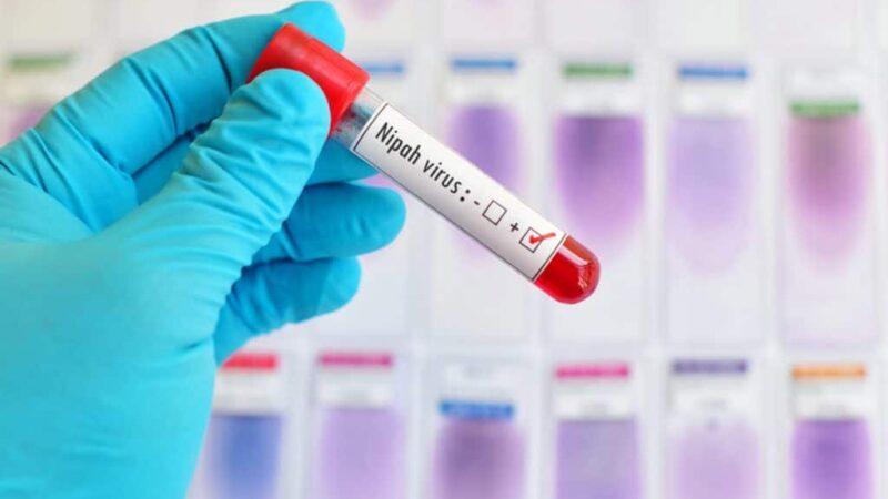 Nipah: novo surto do vírus na Ásia acende alerta em aeroportos