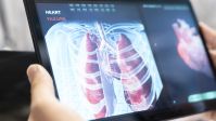 1º transplante hepático intervivos entre adultos é feito com sucesso no NE