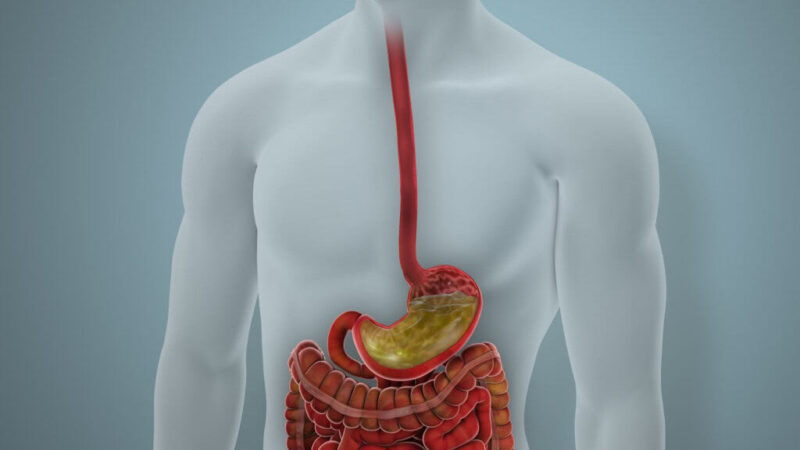 Suco gástrico descartado em endoscopias pode ajudar a detectar câncer de estômago