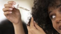 Queda de cabelo não começa no fio, mas no couro cabeludo; perceba os sinais