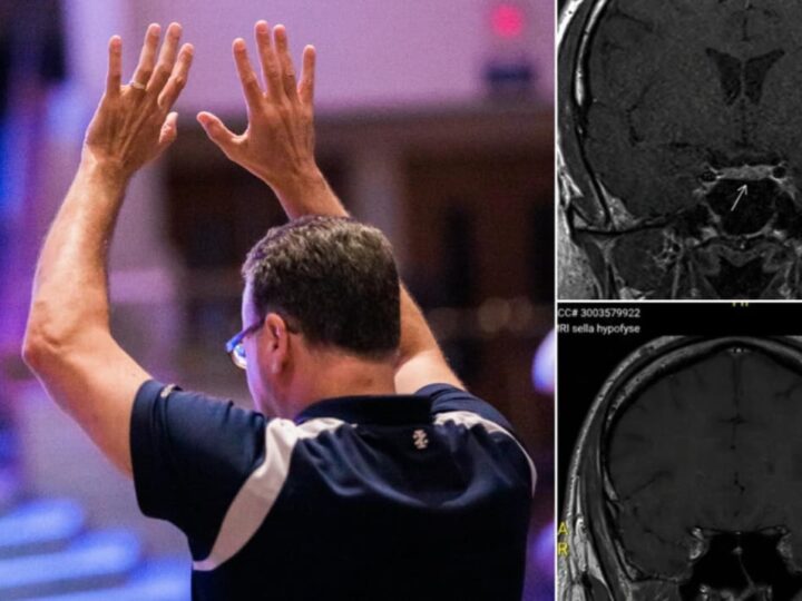 Tumor cerebral em homem desaparece após orações: “Os médicos não entenderam”